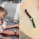 Toshkentda yuqori sinf o‘quvchilari 9 yashar bolaga temir braslet yedirdi (video)