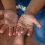 Болалар орасида янги вирус тарқалдими? Санэпидемқўмита изоҳ берди