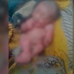 Қудуқдаги чақалоқ илон туфайли қутқарилди