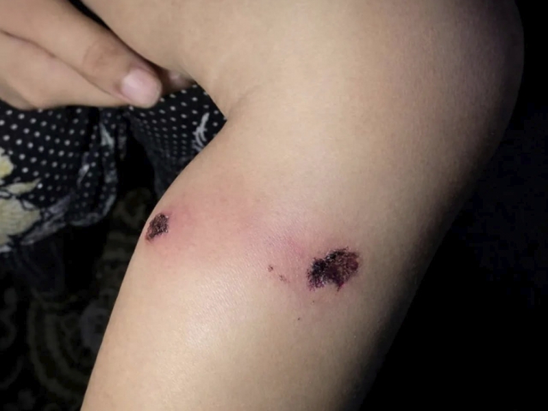 Исроил аскарлари Ғазода 1 ёшли болани оёғига сигарет босиб, қийноққа солди (видео)