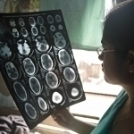 Ҳар йили 11 млн ўлим: ЖССТ огоҳлантирди