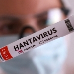 Isroilda hantavirus bilan kasallanishning ilk holati aniqlandi