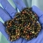 2-year-old girl swallows 250 magnets