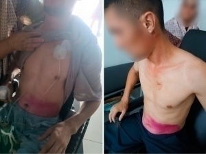 Наманганда ИИБ ходимлари фуқарони ўласи қилиб қийнагани айтилмоқда