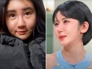 Кореялик аёл 15 йилда 400 та пластик операция ўтказди