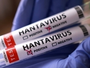 O‘zbekistonda hantavirus yuqtirganlar bormi?