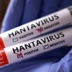 O‘zbekistonda hantavirus yuqtirganlar bormi?