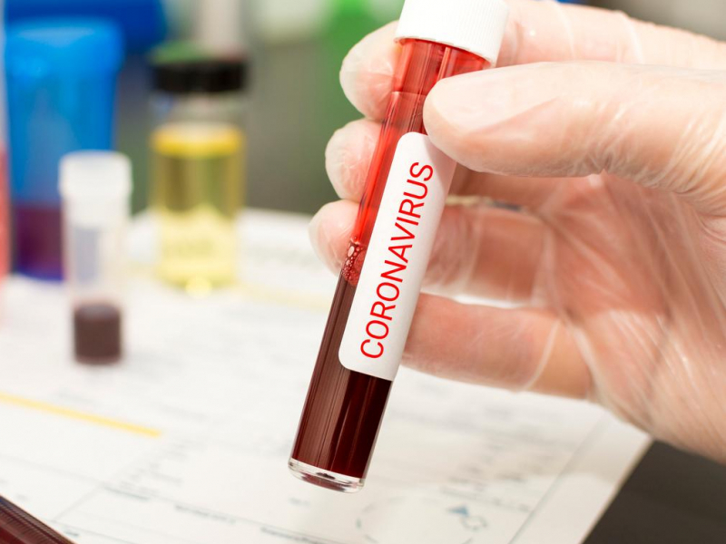 Россия коронавирусга қарши вакцина қачон тайёр бўлишини маълум қилди
