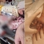 Navoiyda 3 yashar qizning qo‘li go‘sht maydalagichga kirib ketdi