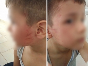 Case was opened against a man who beat a 5-year-old kindergarten child in Bukhara