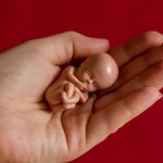 Abort konstitutsiyaviy kafolatlangan huquqlar ro‘yxatidan chiqarib tashlandi