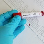 Польшада 11 киши легионеллёздан вафот этди
