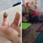 Kindergarten teacher stuck a needle to a child's hand in Khorezm