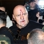 Фьюрининг отаси рақиб жамоа аъзосига “калла қўйгани” учун узр сўради