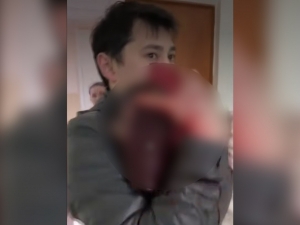 3 ёшли боланинг бошига ғишт тушиб кетди (видео)