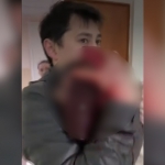 3 yoshli bolaning boshiga g‘isht tushib ketdi (video)