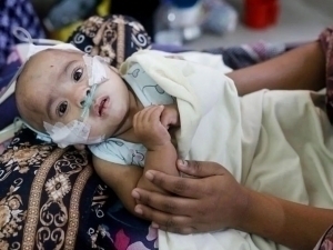 Bangladeshda qizamiqdan 100 nafar bola halok bo‘ldi