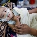 Bangladeshda qizamiqdan 100 nafar bola halok bo‘ldi