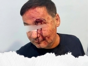 Жиззахда эркак куёви томонидан ўласи қилиб дўппосланди