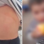 Андижондаги боғчада 2 ёшли бола калтакланди. Бунга чора кўрилдими?