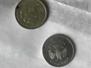 Buxoroda 2 yashar bolaning tomog‘idan ikkita tanga topildi