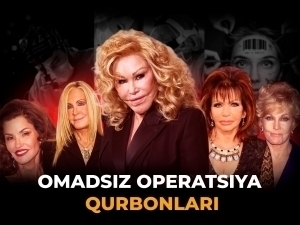 Supermodel va aktrisalar: omadsiz plastik jarrohlik qurbonlari