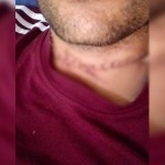 Алимент тўлашдан бош тортган эркак “лезва” билан бўйнини кесиб ташлади