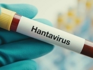 JSST hantavirus bo‘yicha yangi holatlarni ma’lum qildi