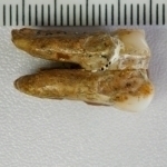 Tishlar inson evolyutsiyasidagi yashirin haqiqatni ochdi