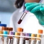 Япониялик олимлар барча қон гуруҳларига мос келадиган сунъий қон яратди