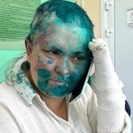 Jurnalist qanday do‘pposlanganini aytib berdi