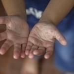 Ўзбекистондаги болалар орасида янгича вирус тарқалдими? 