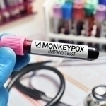 Rossiyada maymunchechak aniqlandi