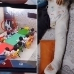 Toshkentdagi xususiy bog‘chada tarbiyachi kaltaklagan bolaning oyog‘i sindi