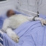 Chirchiqda vagon ustida selfi tushmoqchi bo‘lgan o‘smirni tok urdi