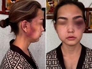 Woman brutally beaten by husband in Surkhandarya