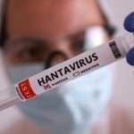 Vaziyat jiddiy: Ispaniya hantavirus tarqalgan kema yo‘lovchilarini karantinga oldi