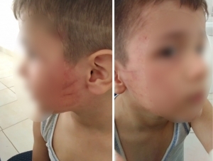 Man assaults a 5-year-old boy who have been fighting with his son in a kindergarten in Bukhara