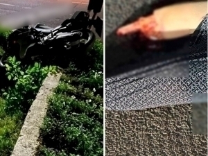 YTHda oyoqlari uzilib ketgan qizning ahvoli qanday?