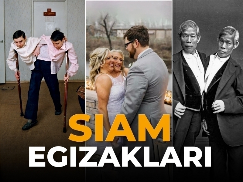 Ikki bosh bitta tana: eng matonatli 9 siam egizagi