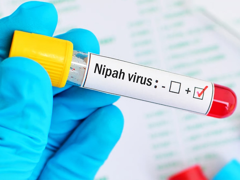 Sanepidqo‘mita o‘zbekistonliklarni Nipah virusi bo‘yicha ogohlantirdi
