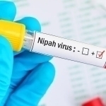 Sanepidqo‘mita o‘zbekistonliklarni Nipah virusi bo‘yicha ogohlantirdi