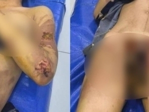 Jizzaxda vahshiylik: kelinning ustidan qaynoq suv quyildi