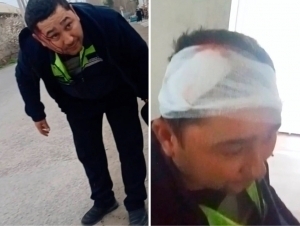 Farg‘onada erkak suv ta’minoti xodimining boshini yordi