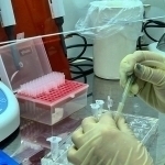 AQSHda sifilis bilan kasallanganlar soni rekord darajaga yetdi
