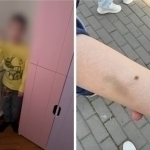 Toshkentda bolani urgan bog‘cha xodimasi yana ishga olindimi? (video)