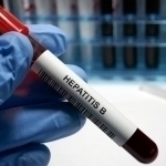 40 мингдан ортиқ ўзбекистонликларда гепатит “B” ва “C” вируслари аниқланди