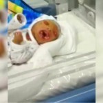 Jizzaxda ko‘p nuqsonli chaqaloq tug‘ildi. SSV holat sabablarini ochiqladi